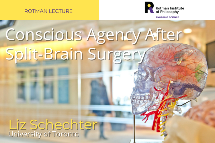 Poster - Speaker: Liz Schechter, University of Maryland Title: Conscious Agency After Split-Brain Surgery